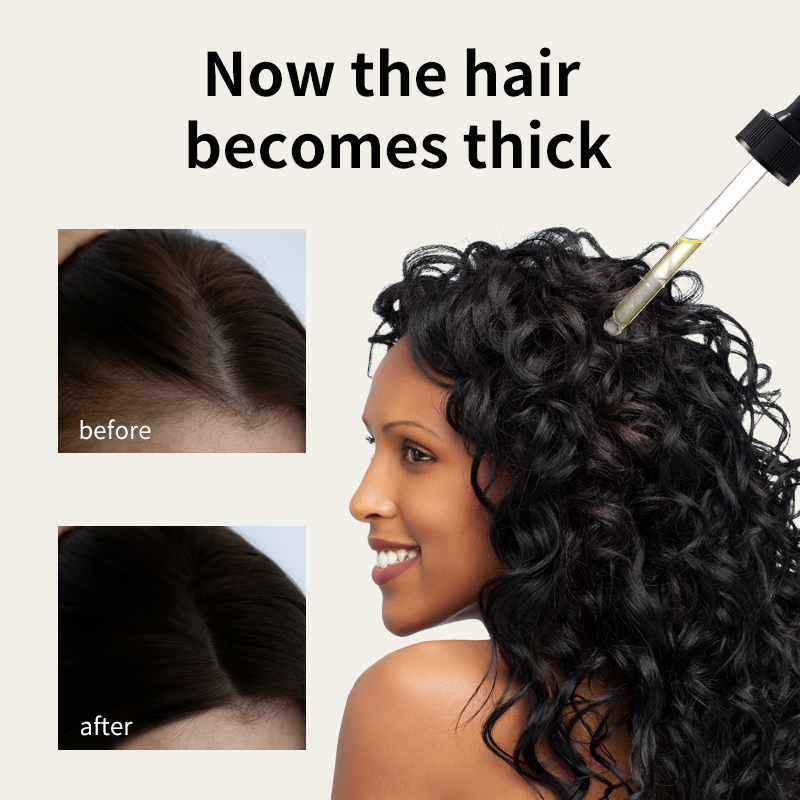 Aceite para el crecimiento del cabello Syulli | Aceite anticaída de romero y jengibre | Estimular los folículos