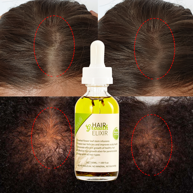 Aceite para el tratamiento del cabello de mujeres negras, hierbas ayurvédicas orgánicas 100% naturales